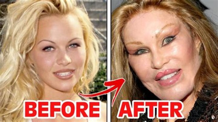 Bridget Fonda Plastic Surgery – Her Before & After Pictures